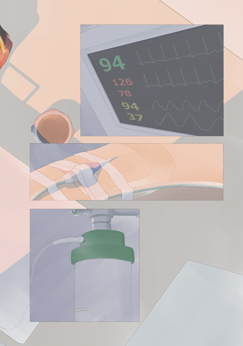 COCOLOPLANT trial page32